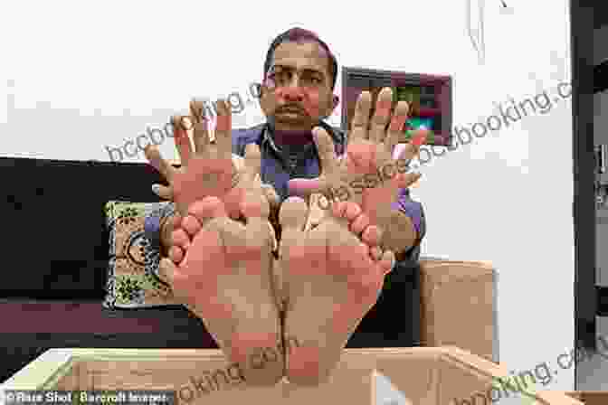 Shashi Immersed In His Artistic World, Using His Eight Fingers And Eight Toes To Create A Vibrant Painting. Eight Fingers And Eight Toes: Accepting Life S Challenges